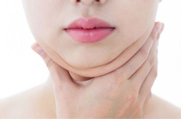 Liposucción Cervical