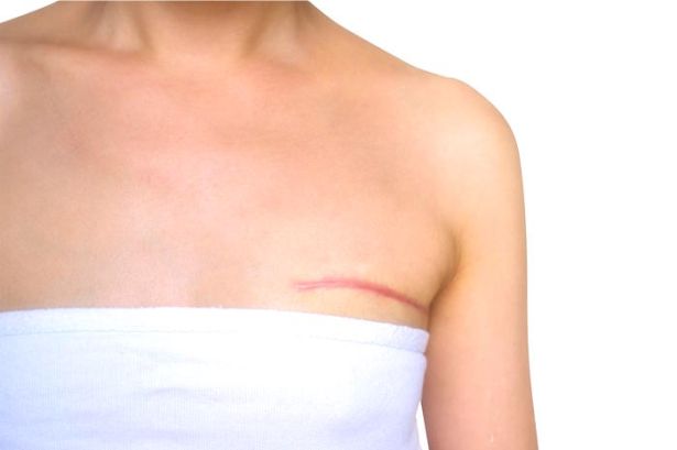 Reconstrucción Mamaria