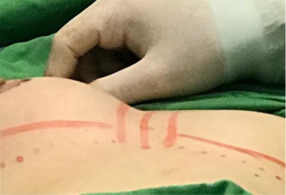 Cirugía Plástica y Estética